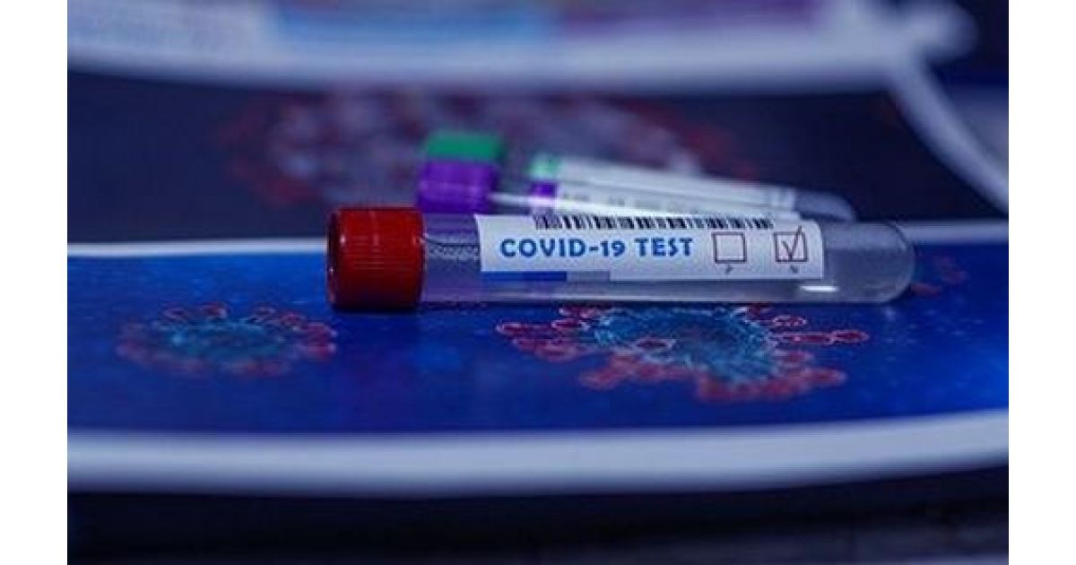 Negatívny test