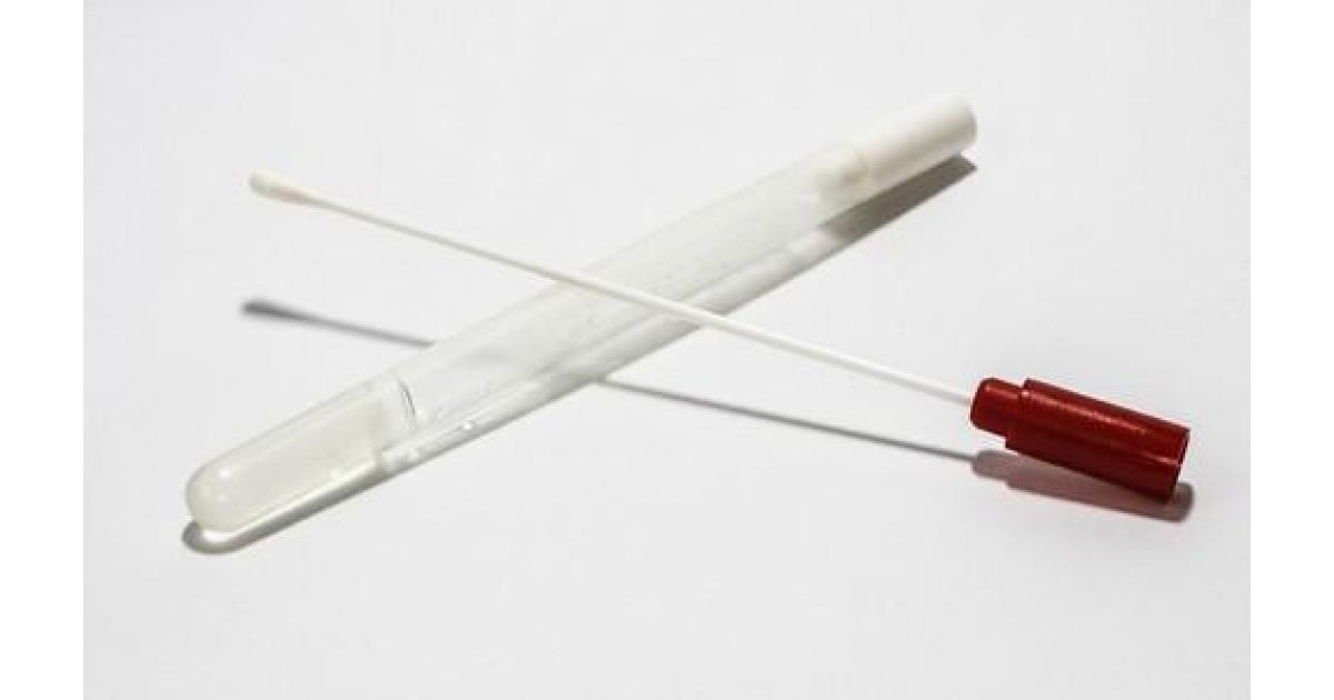 Testovanie antigénovými testami v okrese Rožňava