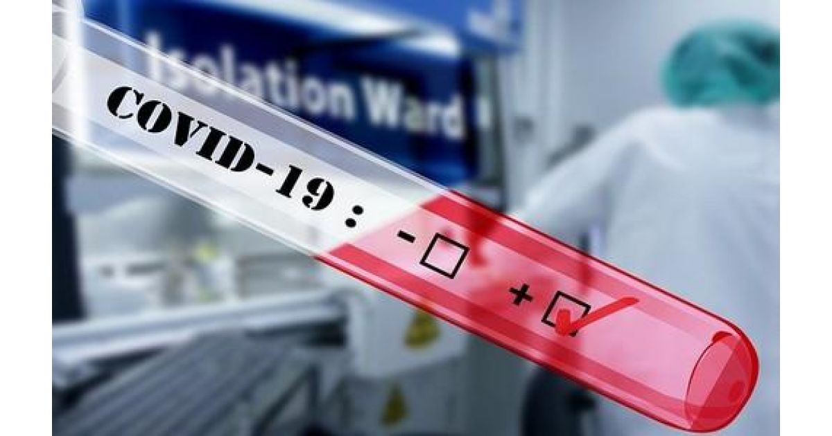 RÚVZ v Rožňave rozširuje testovanie na COVID-19